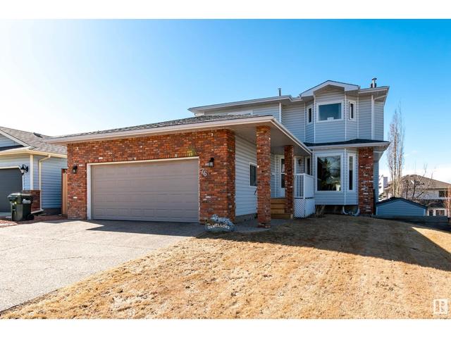 76 Highcliff Rd, House detached with 5 bedrooms, 3 bathrooms and null parking in Edmonton AB | Image 1